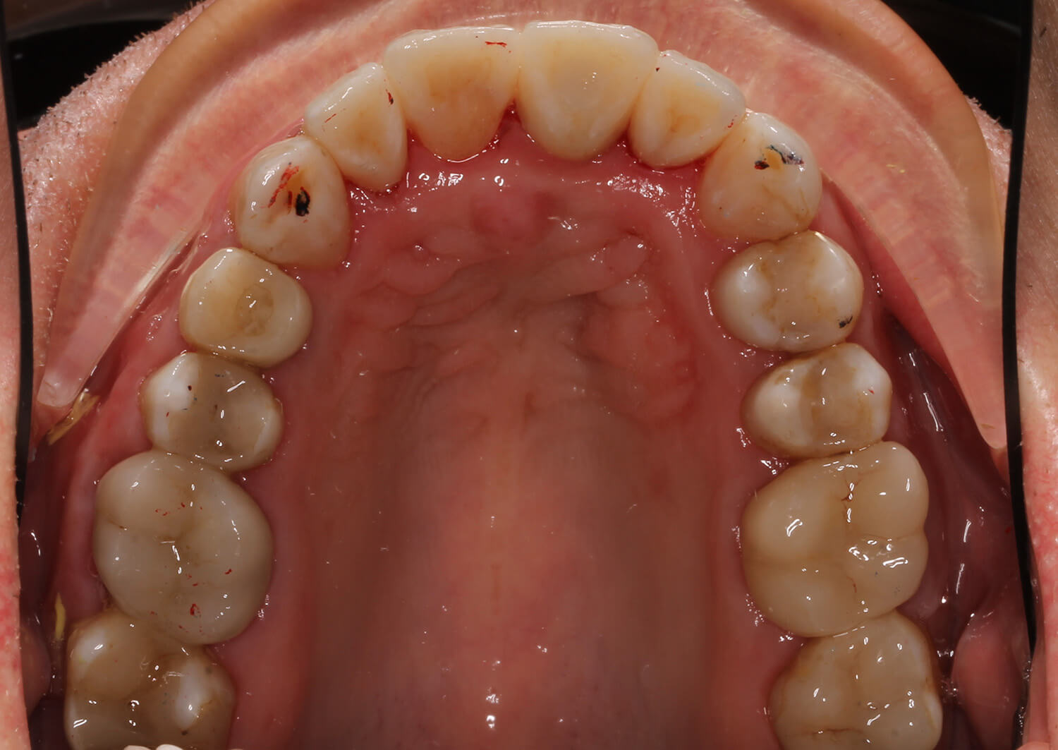 Плохие зубы: истории из жизни, советы, новости, юмор и картинки — Все посты | Пикабу